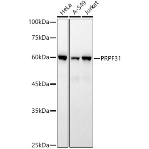 PRPF31 Rabbit mAb