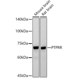 PTPRR Rabbit mAb