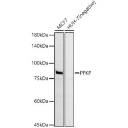 PFKP Rabbit mAb