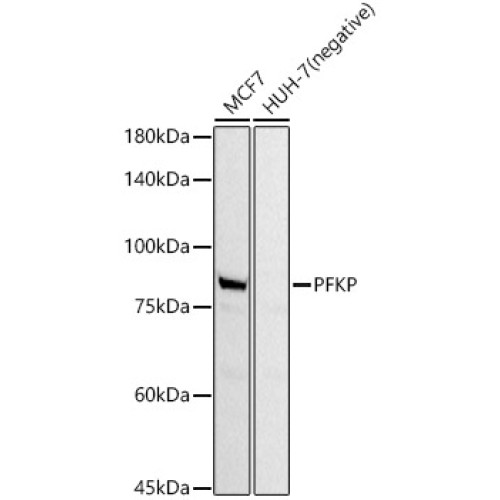 PFKP Rabbit mAb