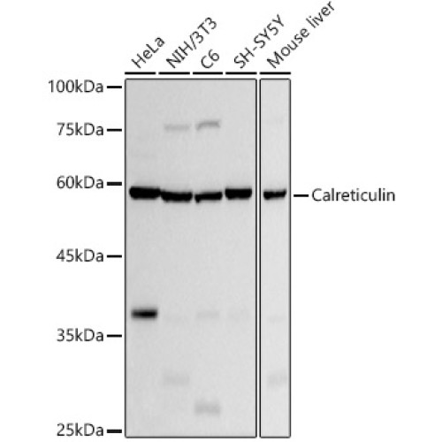 [KO Validated] Calreticulin Rabbit mAb