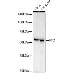 [KO Validated] FTO Rabbit mAb