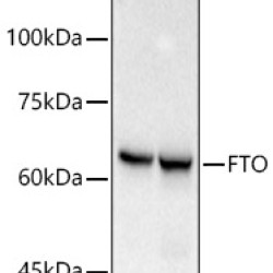 [KO Validated] FTO Rabbit mAb