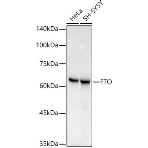 [KO Validated] FTO Rabbit mAb