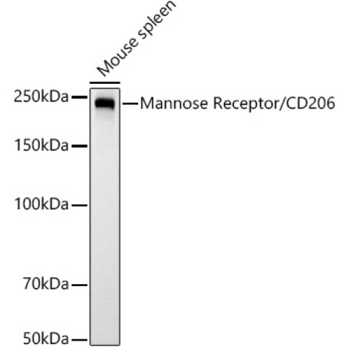 Mannose Receptor/CD206 Rabbit mAb