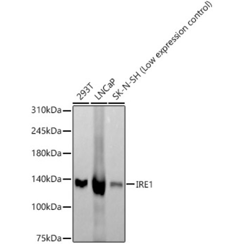 IRE1 Rabbit mAb