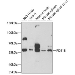 PDE1B Rabbit pAb
