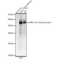 SARS-CoV-2 Nucleoprotein Rabbit mAb