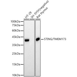 STING/TMEM173 Rabbit mAb