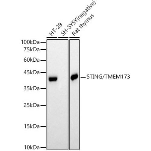 STING/TMEM173 Rabbit mAb