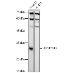 HSD17B13 Rabbit mAb