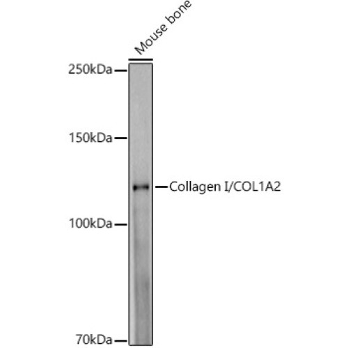 Collagen I/COL1A2 Rabbit mAb