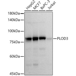 PLOD3 Rabbit mAb