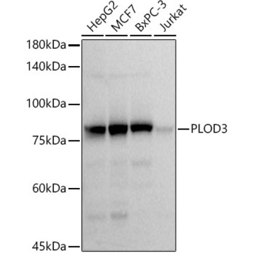 PLOD3 Rabbit mAb