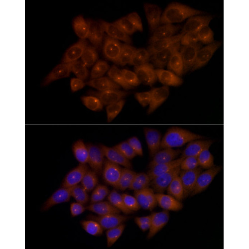 CEP43 Rabbit mAb