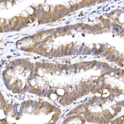 SFT Rabbit mAb