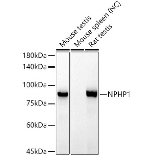 NPHP1 Rabbit mAb