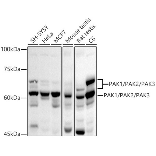 PAK1/PAK2/PAK3 Rabbit pAb