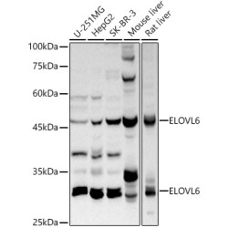 ELOVL6 Rabbit pAb