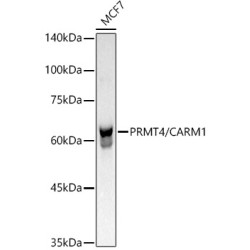 [KO Validated] PRMT4/CARM1 Rabbit mAb