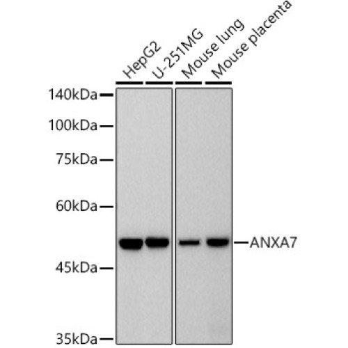 ANXA7 Rabbit mAb