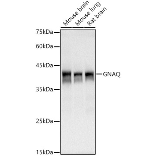 GNAQ Rabbit mAb