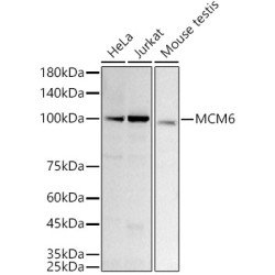 [KD Validated] MCM6 Rabbit mAb