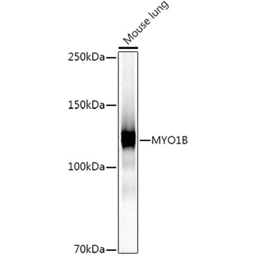 MYO1B Rabbit mAb
