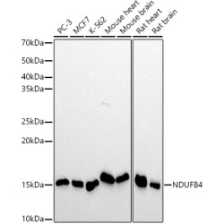 NDUFB4 Rabbit mAb