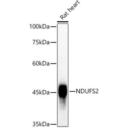 NDUFS2 Rabbit mAb