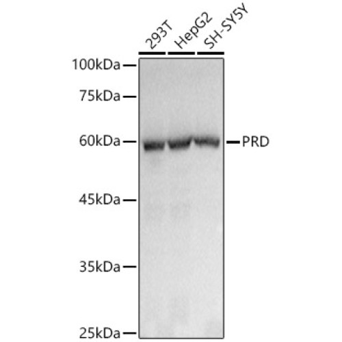 PRD Rabbit mAb