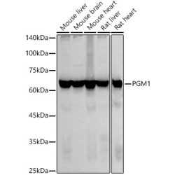 PGM1 Rabbit mAb