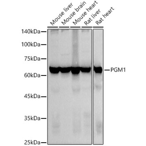 PGM1 Rabbit mAb