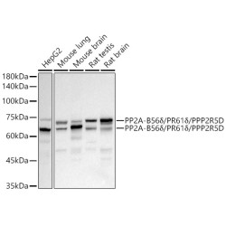 PP2A-B56δ/PR61δ/PPP2R5D Rabbit mAb