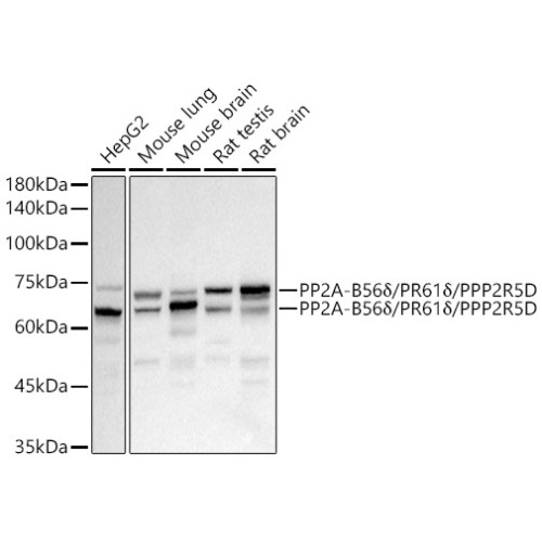 PP2A-B56δ/PR61δ/PPP2R5D Rabbit mAb