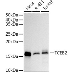 TCEB2 Rabbit mAb