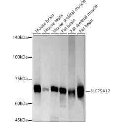 SLC25A12 Rabbit mAb