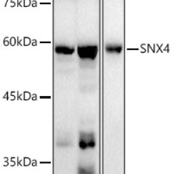 SNX4 Rabbit mAb