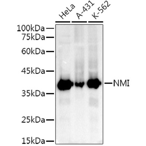 NMI Rabbit mAb