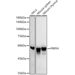 PRPF4 Rabbit mAb