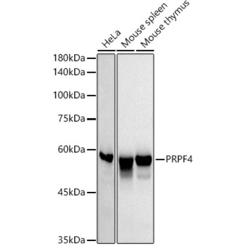 PRPF4 Rabbit mAb