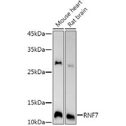 RNF7 Rabbit mAb