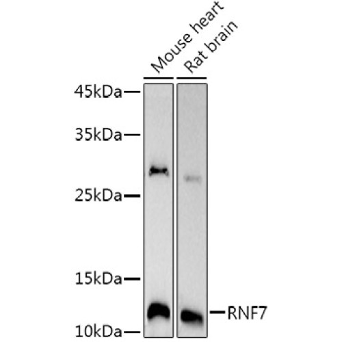 RNF7 Rabbit mAb