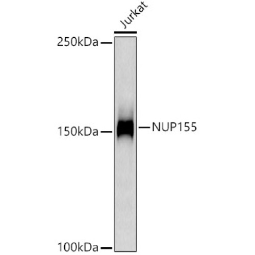NUP155 Rabbit mAb