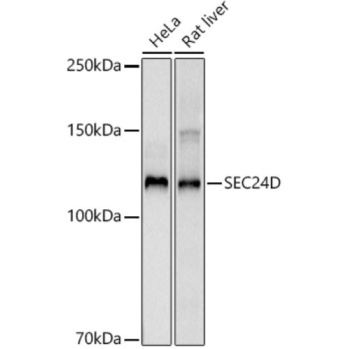SEC24D Rabbit mAb