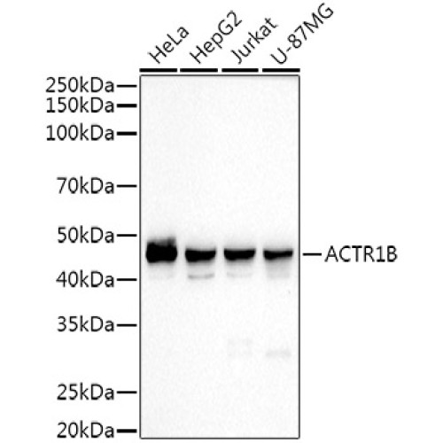 ACTR1B Rabbit mAb