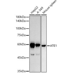 ATE1 Rabbit mAb