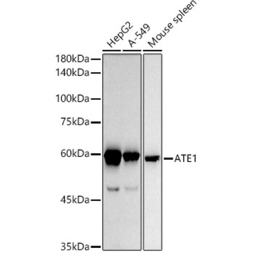 ATE1 Rabbit mAb