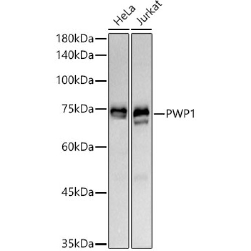 PWP1 Rabbit mAb