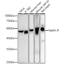 Septin 8 Rabbit mAb